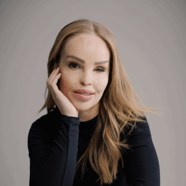 Katie Piper